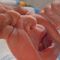 Ten ch�opczyk urodzi� si� bez krwi w �y�ach. Lekarze cudem go ocalili