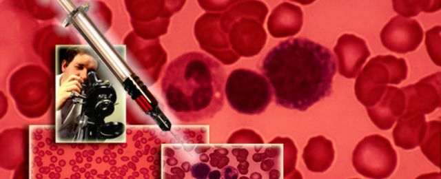 Malaria, HIV i gru�lica w odwrocie
