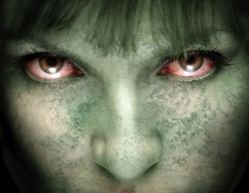 Syndrom Morgellon�w. Najdziwniejsza choroba �wiata atakuje
