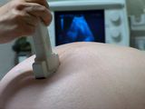 Warunki zdrowej ci��y wed�ug lekarzy