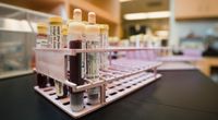 95% nie�wiadomych nosicieli HCV!