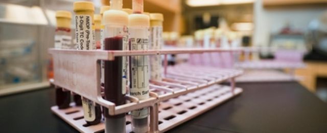 95% nie�wiadomych nosicieli HCV! 