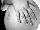 Badania prenatalne