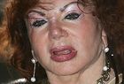 Twarz Jackie Stallone si� rozpadnie?