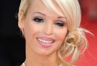 Modelka wygl�da coraz lepiej
