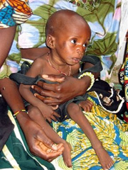 Amerykański gigant farmaceutyczny odpowiada za śmierć nigeryjskich dzieci?