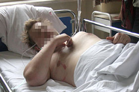 24-letni desperat skoczy� z 8. pi�tra - prze�y�...