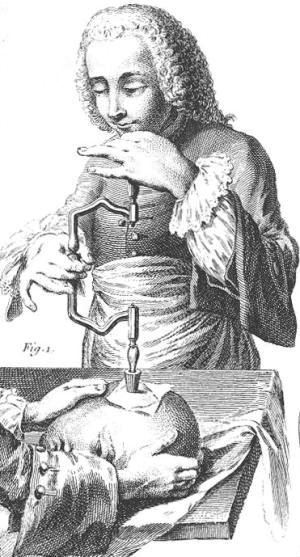 Trepanacja, kraniotomia i kraniektomia