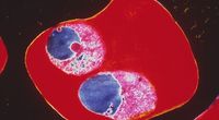 Malaria uodparnia si� na leki
