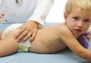 Nowa szczepionka ma uratowa� �ycie setek tysi�cy dzieci 