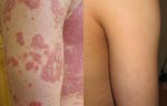 �USZCZYCA ZNIKA NATURALNIE