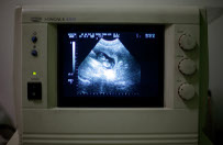 Pora�ka polskich zwolennik�w aborcji