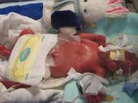 Ten malec w momencie narodzin wa�y� 450 gram�w. Wbrew prognozom lekarzy, prze�y�!