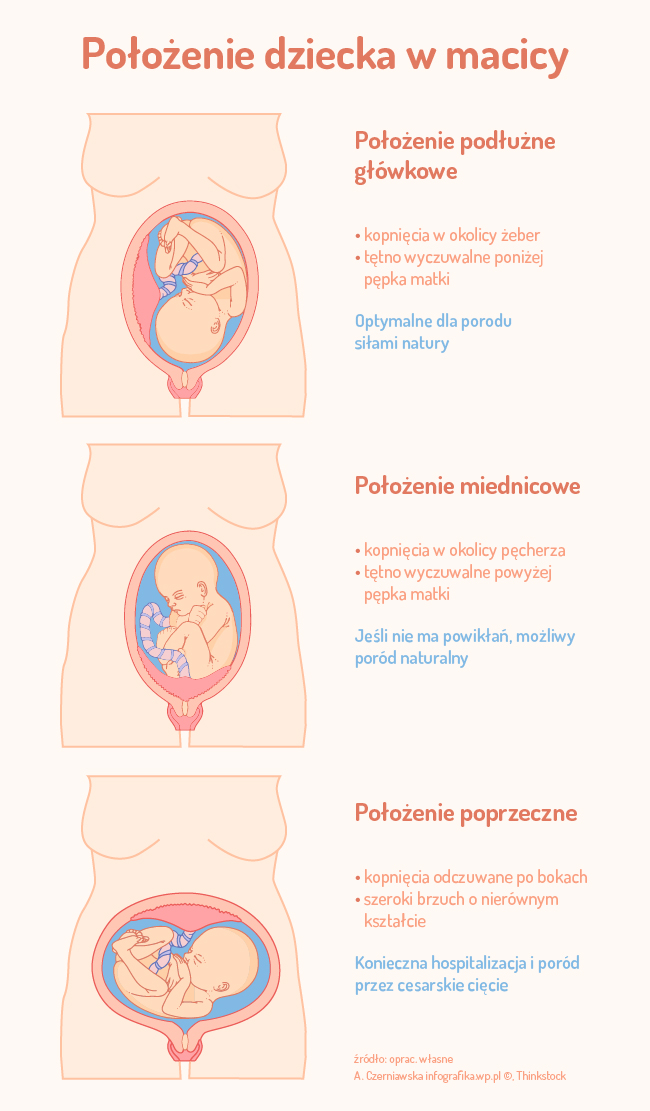 Ułożenie Dziecka W Macicy Strona 3 Dzieci Pl