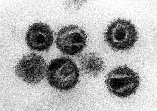 Wirus HIV