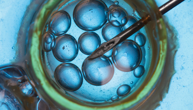 Chcesz mieć pewność, że w trakcie in vitro nie doszło do pomyłki? Zrób badanie DNA
